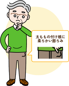 太ももの付け根に柔らかい膨らみが出る鼠径ヘルニアの症状を示すイラスト