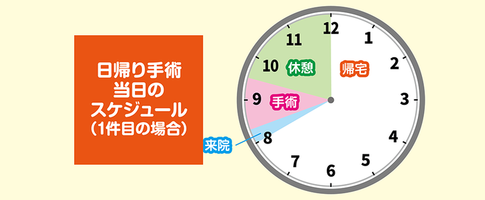 日帰手術スケジュール