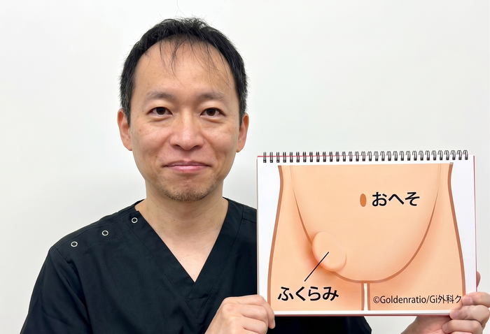 医師が鼠径ヘルニアの図を持っています。